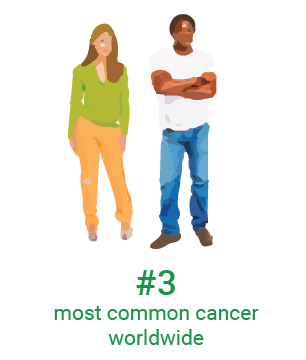 illustration on colon cancer statistics